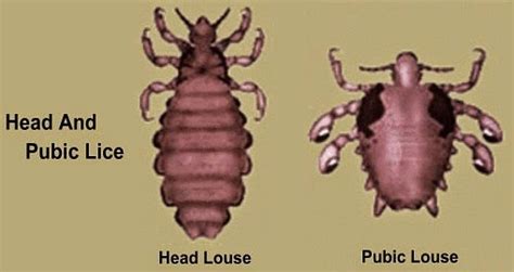 Sexual Health Pubic Lice Haemosexual