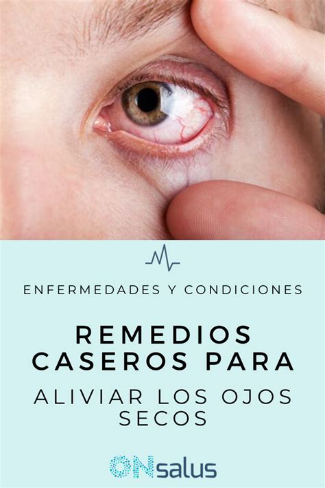 Remedios caseros para aliviar los ojos secos los más eficaces Remedios caseros Remedios Ojos