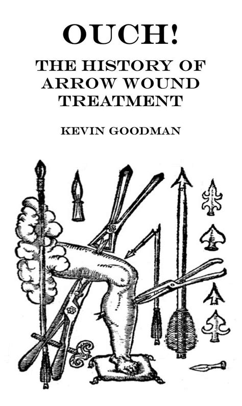 Ouch The History Of Arrow Wound Treatment By Kevin Goodman Goodreads