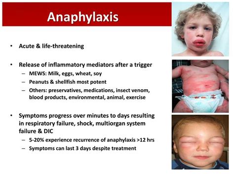 Anaphylaxis information including symptoms, diagnosis, treatment, causes, videos, forums, and local community support. PPT - Pediatric Respiratory Emergencies PowerPoint Presentation - ID:1743190