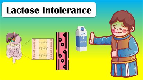 Lactose Intolerance Types Causes Pathophysiology Signs Symptoms