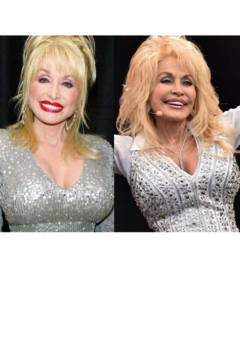 Dolly Parton Plastic Surgery Considering Dollys Love Of Plastic