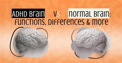 Adhd Brain Vs Normal Brain Functions Differences And More