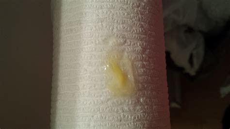 Yellow Stretchy Cervical Mucus