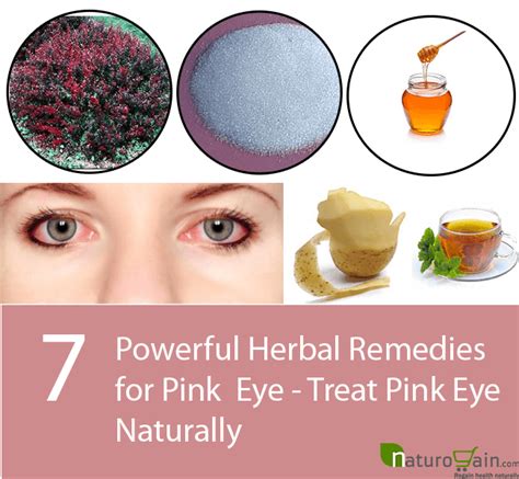 7 Powerful Herbal Remedies For Pink Eye Treat Pink Eye Naturally
