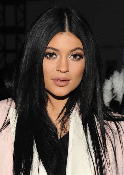 Pics Kylie Jenners Plastic Surgery — Has The 17 Year Old Gone Too