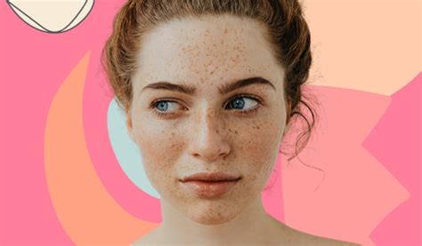 How To Get Rid Of Freckles Without Makeup Saubhaya Makeup