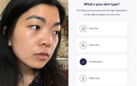 Doesn't seem to be bs on the surface. How Does the Skin-Care App Curology Work? We Tried It ...