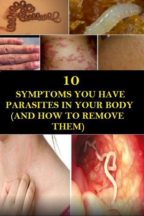 10 Symptoms You Have Parasites In Your Body And How To Remove Them Parasite Symptoms