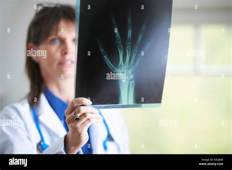 Xray Hand Hi Res Stock Photography And Images Alamy