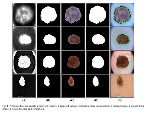 An Integrated Framework Of Skin Lesion Detection And Recognition