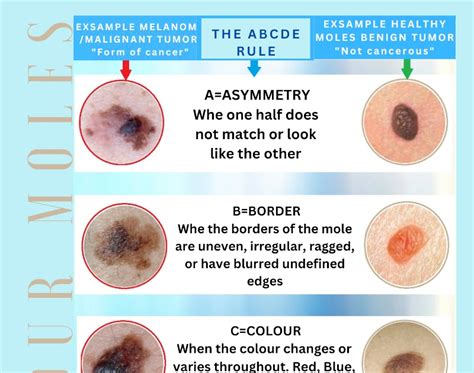 Know Your Moles Poster