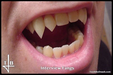 Interview With A Vampire Teeth