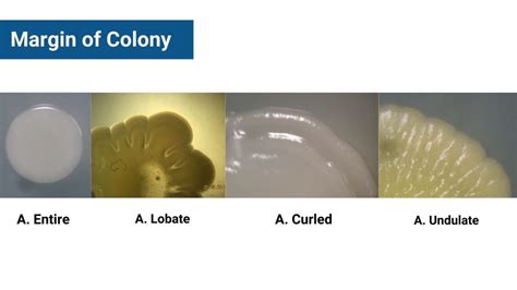 Colony Morphology Of Bacteria And Examples