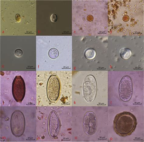 Parasites Identified In Stool Samples From Nhps A Giardia Sp B
