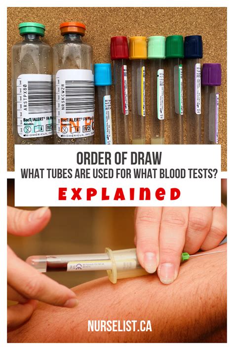 How To Remember The Order Of Draw What Tubes Are Used For What Blood Tests Artofit