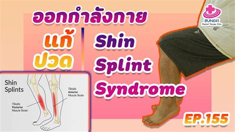 ออกกำลังกายแก้ปวด Shin Splint Syndrome กายภาพง่ายๆกับบัณฑิต Ep155 Youtube