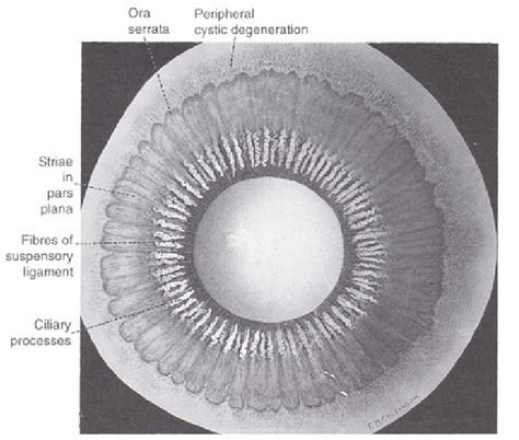 Posterior View Of The Ciliary Body Showing Ciliary Processes And Part