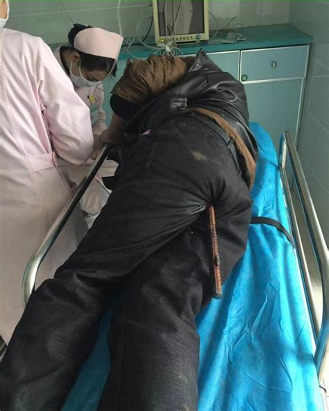 construction worker miraculously survives being impaled by rusty bar which shot through his