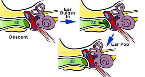 Read about why ear popping happens, how to pop your ears and if it's safe. Ear Noises | Know About unusual Weird Sounds Inside Your Ear