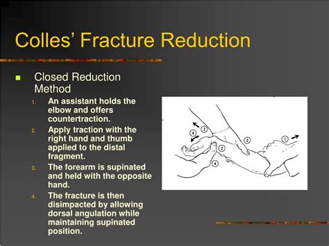 PPT - Dislocation and Fracture Reductions PowerPoint ...
