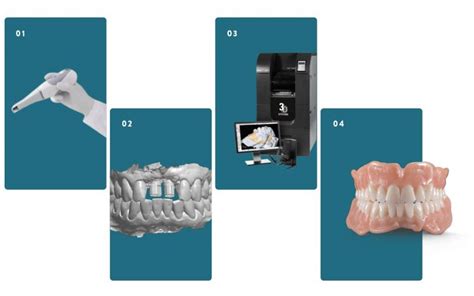 cad cam digital denture framework — stomadent dental laboratory