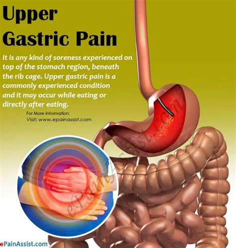 Upper Stomach Pain Gambaran