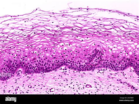 El epitelio del cuello uterino Micrografía de luz de tejido epitelial
