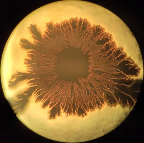 Eye Shaped Bacteria Colony Under The Microscope Photograph By Chirila