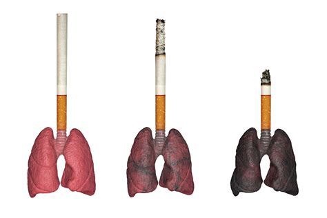 Smokers Lungs After Quitting Smoking