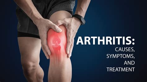 what is arthritis causes symptoms and treatment