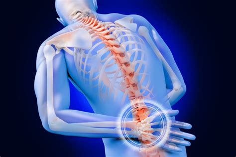 The other vehicle's insurance company paid this. Attorney Settles Disc Injury Car Accident Denton, TX $30,000