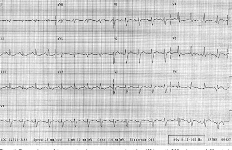 Figure 1 From Sudden Cardiac Death In A 30 Year Old Pregnant Woman