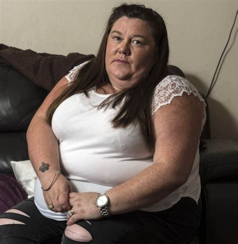 Mum Left Covered In Bed Bug Bites After Stay At Pontins Holiday Park