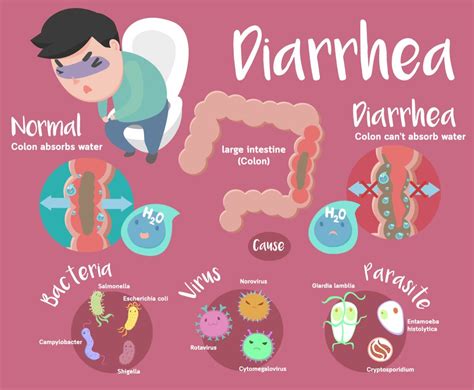 Diarrhea Guide Causes Symptoms And Treatment Options Gambaran