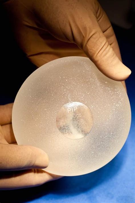 Adulterated And Explanted Poly Implant Prothese Pip French Breast Implants Superstock