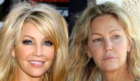 Heather Locklear Before And After Plastic Surgery 3 Celebrity Plastic
