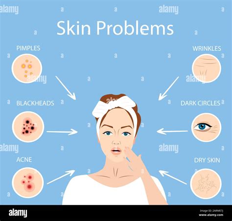 Vector Of A Worried Woman With Face Skin Problems Stock Vector Image