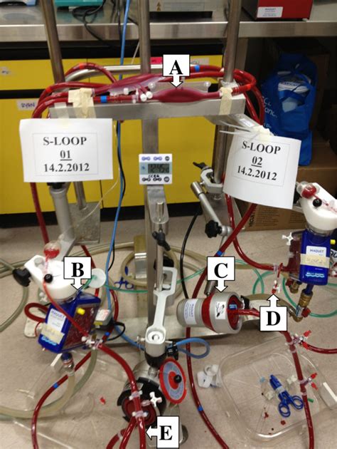 The basic components in an ecmo circuit are the inflow/outflow cannulas, a pump, and a membrane oxygenator with heat exchanger where oxygen and carbon dioxide are exchanged. Ex vivo ECMO circuit model. A -reservoir bladder, B ...