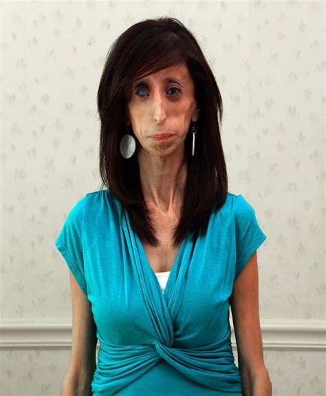 woman cruelly dubbed world s ugliest reveals amazing way she copes