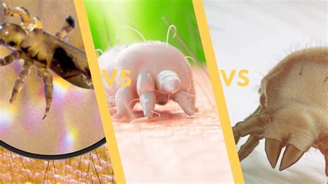 Dust Mites Vs Lice Vs Scabies Vs Bed Bugs Complete Guide