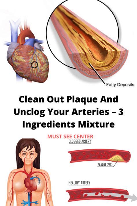 clean out plaque and unclog your arteries 3 ingredients mixture with