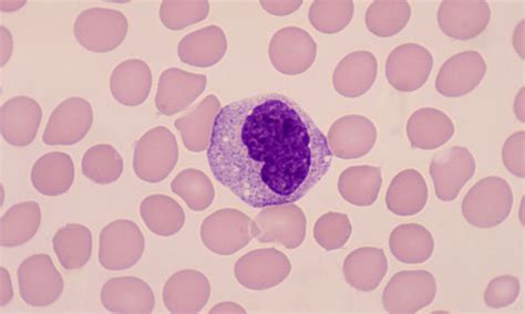 What Does High Monocytes Mean In Dogs