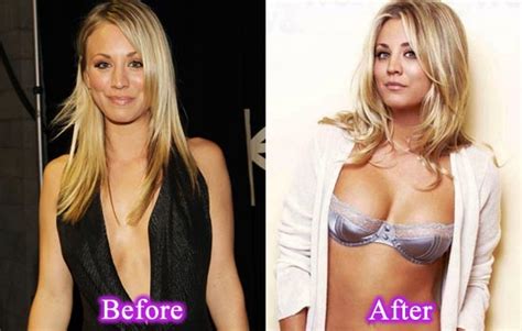 Kaley Cuoco Plastic Surgery Picture The Mike O Meara Show