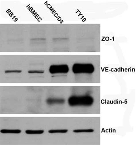 Western Blot Analysis Of Tight Junction Proteins Zo Claudin And