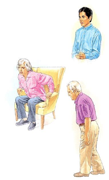 Como se produce el temblor en pacientes con parkinson? Los temblores de fijación ocular pueden ser indicador un ...
