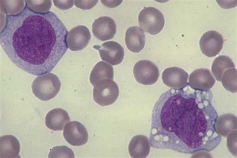 Two Young Monocytes Medical Laboratories