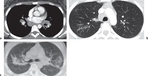 16 Lungs Radiology Key