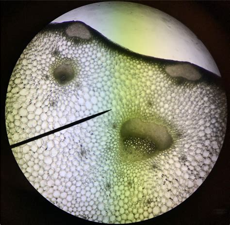 Xylem And Phloem Diagram Of Celery