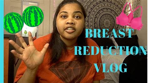 My Breast Reduction Journey 1 Youtube